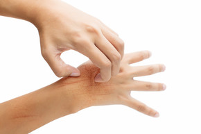thumbimg