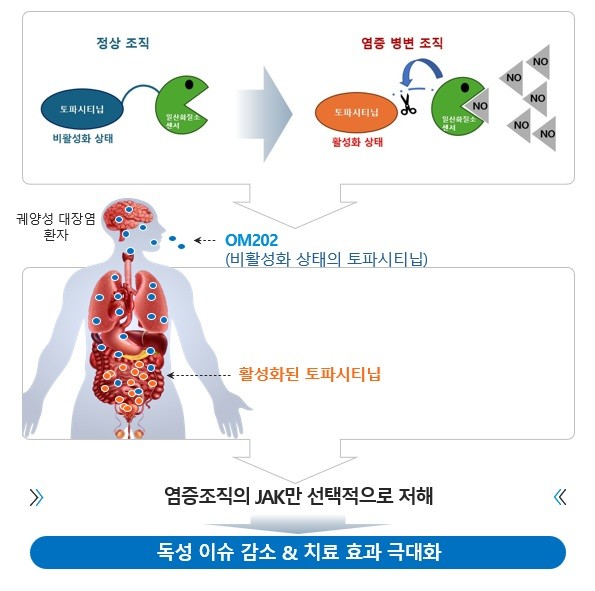 궤양성 대장염 치료제 원스톱 개발 지...
